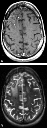 Fig 1.