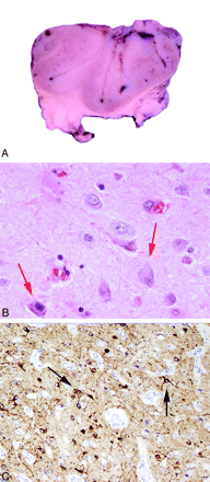 Fig 3.