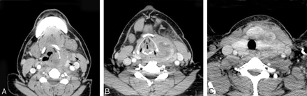Fig 1.