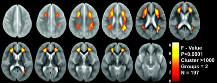Fig 2.