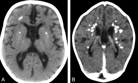 Fig 2.