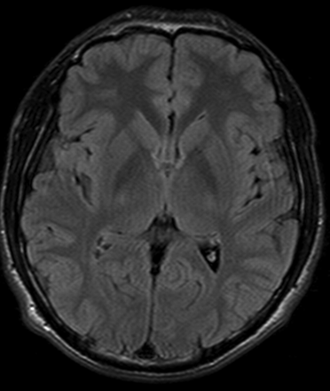 Fig 1.