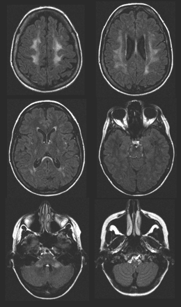 Fig 5.