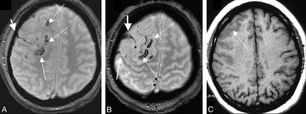 Fig 1.