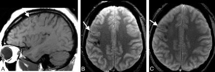 Fig 2.