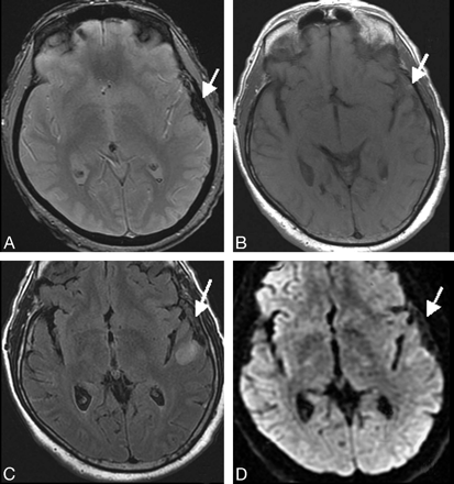 Fig 3.