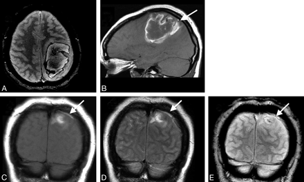 Fig 5.
