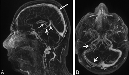 Fig 2.