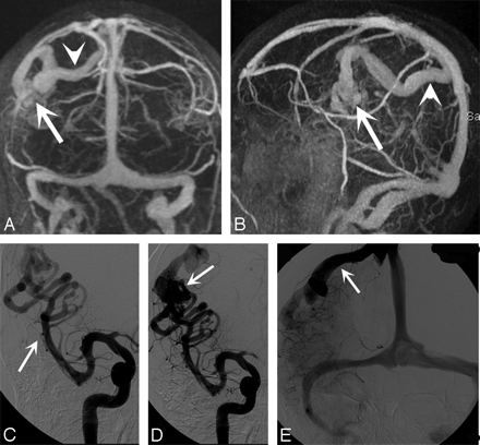 Fig 3.