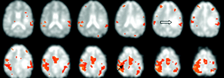 Fig 3.