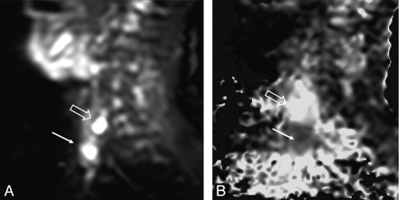 Fig 2.