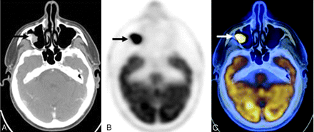 Fig 2.