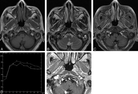 Fig 1.