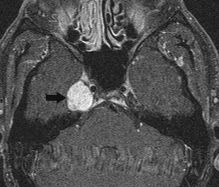 Fig 2.