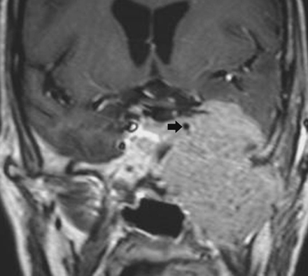 Fig 3.
