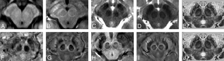 Fig 2.