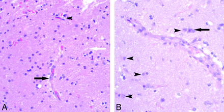 Fig 2.