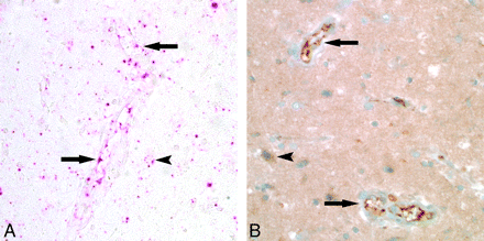 Fig 4.