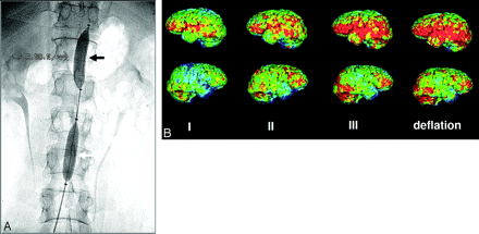 Fig 7.