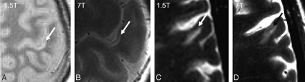Fig 1.