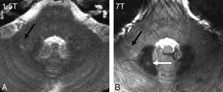 Fig 3.