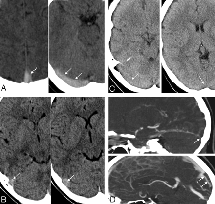 Fig 2.