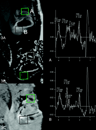 Fig 3.