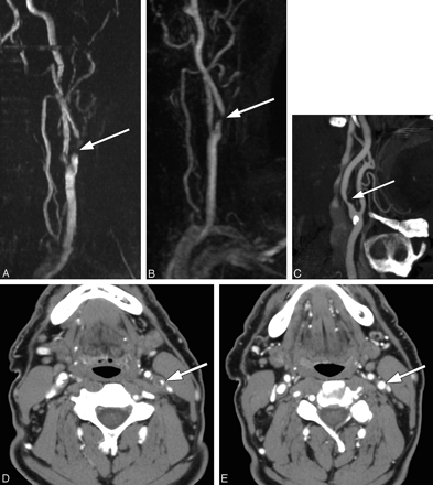 Fig 1.