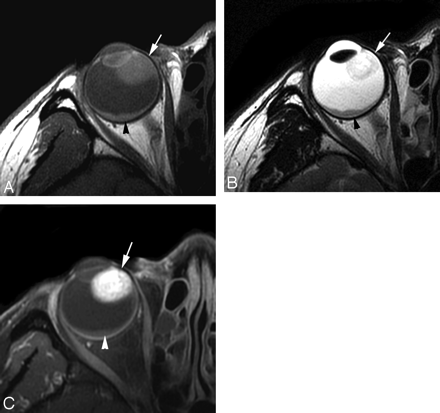 Fig 2.