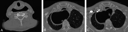 Fig 2.