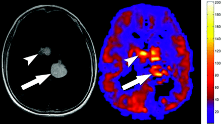 Fig 4.