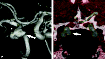 Fig 3.