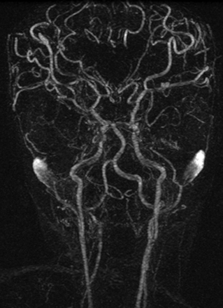 Fig 2.