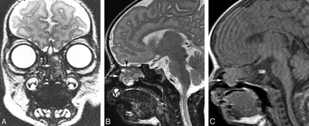 Fig 1.
