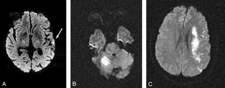 Fig 1.