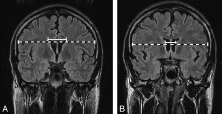 Fig 1.