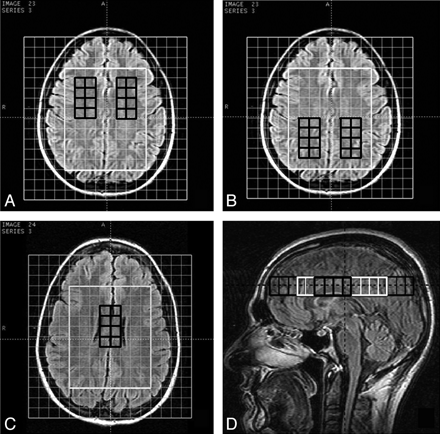 Fig 3.