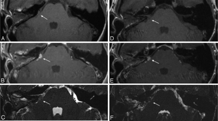 Fig 3.