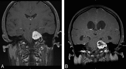 Fig 2.