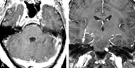 Fig 4.