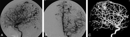 Fig 2.