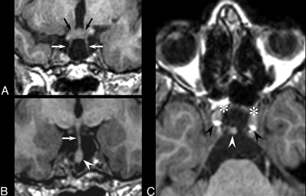 Fig 1.