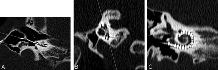 Fig 1.