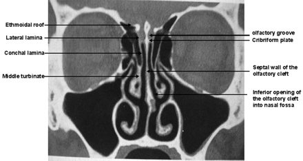 Fig 1.