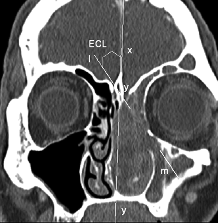 Fig 3.