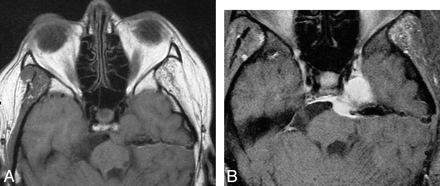   Fig 5. 