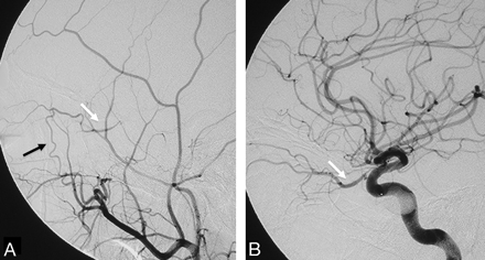 Fig 3.