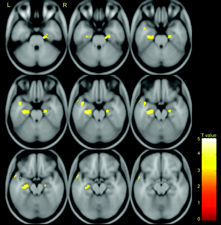 Fig 2.