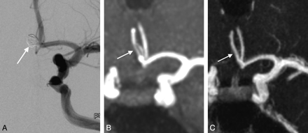 Fig 1.