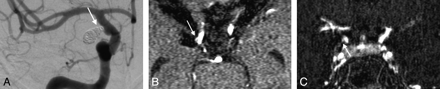 Fig 3.